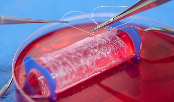 Close-up of the engineering of a vagina in a red petri dish in the regenerative laboratory.